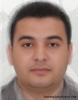 Male representative of African Alpinoid