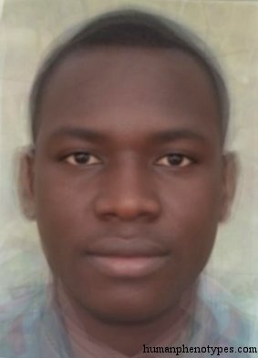 Sudanid male phenotype example